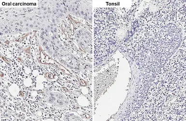 Anti-CD105 antibody [HL5572] used in IHC (Paraffin sections) (IHC-P). GTX646254