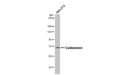Anti-Caldesmon antibody [HL5575] used in Western Blot (WB). GTX646257