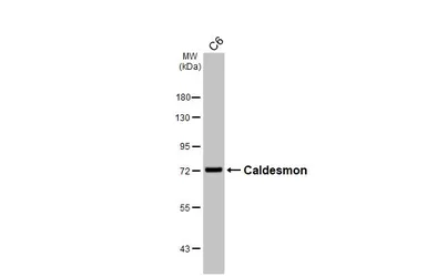 Anti-Caldesmon antibody [HL5575] used in Western Blot (WB). GTX646257