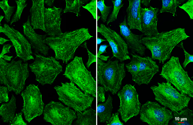 Anti-Caldesmon antibody [HL5575] used in Immunocytochemistry/ Immunofluorescence (ICC/IF). GTX646257