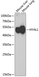 Anti-HYAL1 antibody used in Western Blot (WB). GTX64626