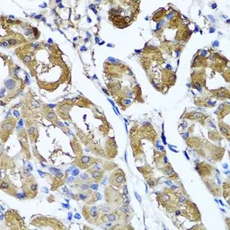 Anti-HYAL1 antibody used in IHC (Paraffin sections) (IHC-P). GTX64626