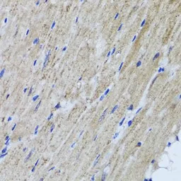 Anti-HYAL1 antibody used in IHC (Paraffin sections) (IHC-P). GTX64626