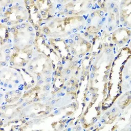 Anti-HYAL1 antibody used in IHC (Paraffin sections) (IHC-P). GTX64626