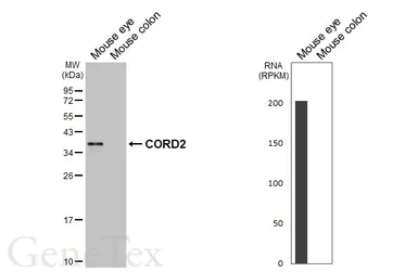 Anti-CORD2 antibody [HL5578] used in Western Blot (WB). GTX646260