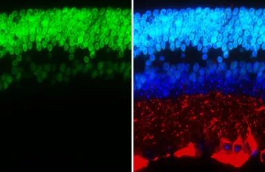 Anti-CORD2 antibody [HL5578] used in IHC (Paraffin sections) (IHC-P). GTX646260
