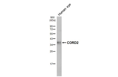 Anti-CORD2 antibody [HL5578] used in Western Blot (WB). GTX646260