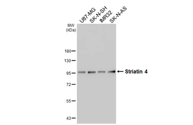 Anti-Striatin 4 antibody [HL5583] used in Western Blot (WB). GTX646265