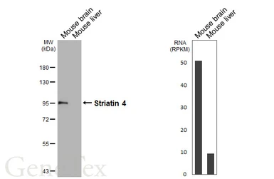 Anti-Striatin 4 antibody [HL5583] used in Western Blot (WB). GTX646265