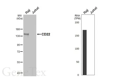 Anti-CD22 antibody [HL5598] used in Western Blot (WB). GTX646280