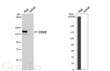 Anti-CD22 antibody [HL5599] used in Western Blot (WB). GTX646281