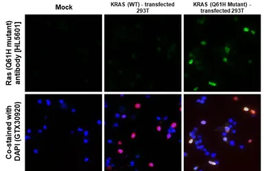 Anti-Ras (Q61H mutant) antibody [HL5601] used in IHC-P (cell pellet) (IHC-P (cell pellet)). GTX646283