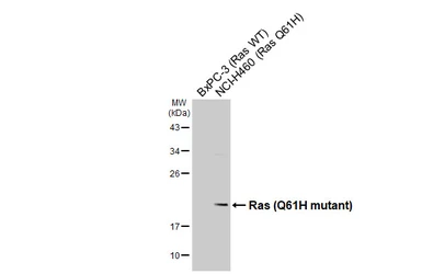 Anti-Ras (Q61H mutant) antibody [HL5601] used in Western Blot (WB). GTX646283