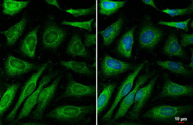 Anti-14-3-3 epsilon antibody [HL5606] used in Immunocytochemistry/ Immunofluorescence (ICC/IF). GTX646288