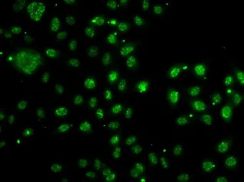 Anti-ARH antibody used in Immunocytochemistry/ Immunofluorescence (ICC/IF). GTX64629