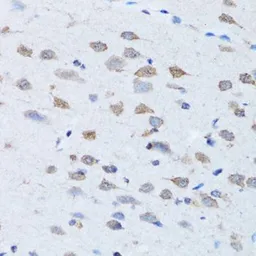 Anti-ARH antibody used in IHC (Paraffin sections) (IHC-P). GTX64629