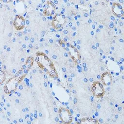 Anti-ARH antibody used in IHC (Paraffin sections) (IHC-P). GTX64629