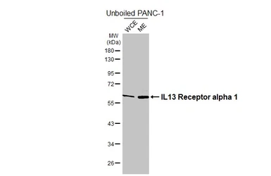 Anti-IL13 Receptor alpha 1 antibody [HL5609] used in Western Blot (WB). GTX646291