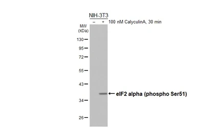 Anti-eIF2 alpha (phospho Ser51) antibody [HL5614] used in Western Blot (WB). GTX646296