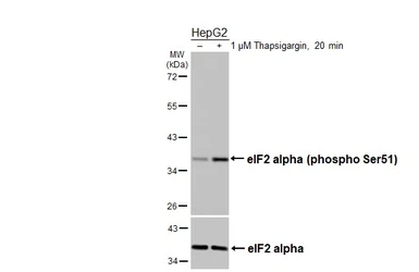 Anti-eIF2 alpha (phospho Ser51) antibody [HL5614] used in Western Blot (WB). GTX646296