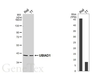 Anti-UBIAD1 antibody [HL5615] used in Western Blot (WB). GTX646297
