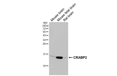 Anti-CRABP2 antibody [HL5622] used in Western Blot (WB). GTX646311