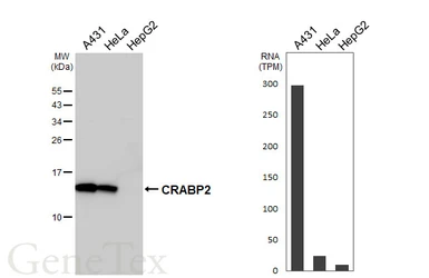 Anti-CRABP2 antibody [HL5622] used in Western Blot (WB). GTX646311