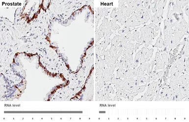 Anti-CRABP2 antibody [HL5622] used in IHC (Paraffin sections) (IHC-P). GTX646311