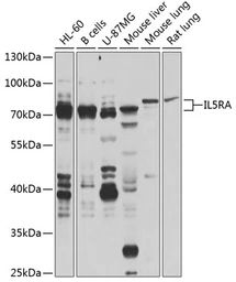 Anti-IL5 Receptor alpha antibody used in Western Blot (WB). GTX64632