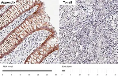 Anti-LI-Cadherin antibody [HL5636] used in IHC (Paraffin sections) (IHC-P). GTX646325