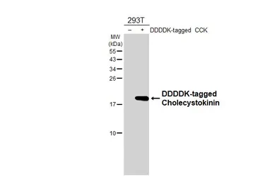 Anti-Cholecystokinin antibody [HL5639] used in Western Blot (WB). GTX646328