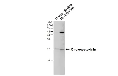Anti-Cholecystokinin antibody [HL5639] used in Western Blot (WB). GTX646328