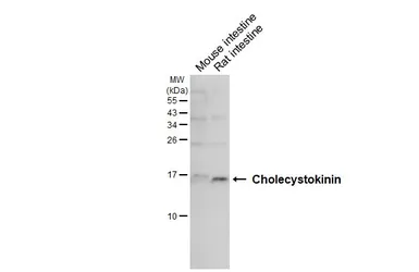 Anti-Cholecystokinin antibody [HL5640] used in Western Blot (WB). GTX646329