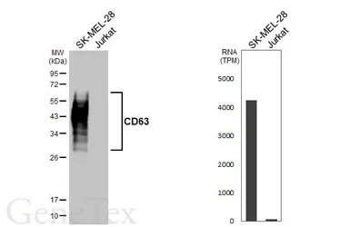 Anti-CD63 antibody [GT366] used in Western Blot (WB). GTX646339