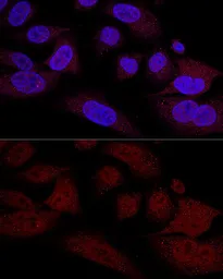 Anti-TAZ antibody used in Immunocytochemistry/ Immunofluorescence (ICC/IF). GTX64636