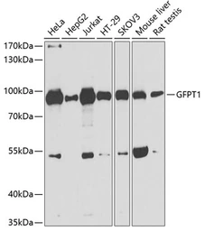 Anti-GFPT1 antibody used in Western Blot (WB). GTX64638