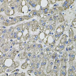 Anti-GFPT1 antibody used in IHC (Paraffin sections) (IHC-P). GTX64638