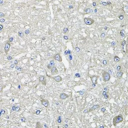 Anti-GFPT1 antibody used in IHC (Paraffin sections) (IHC-P). GTX64638