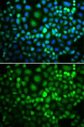 Anti-RUVBL2 antibody used in Immunocytochemistry/ Immunofluorescence (ICC/IF). GTX64643