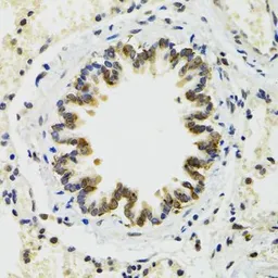 Anti-RUVBL2 antibody used in IHC (Paraffin sections) (IHC-P). GTX64643