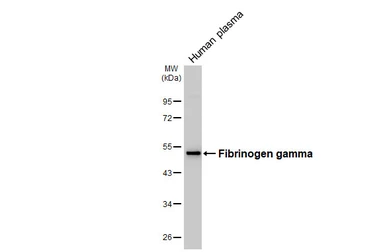 Anti-Fibrinogen gamma antibody [HL5648] used in Western Blot (WB). GTX646457