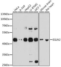 Anti-PHD1 antibody used in Western Blot (WB). GTX64646