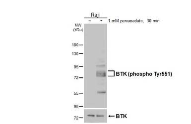 Anti-BTK (phospho Tyr551) antibody [HL5655] used in Western Blot (WB). GTX646464