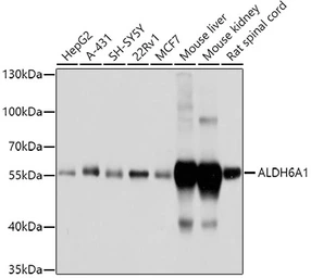 Anti-ALDH6A1 antibody used in Western Blot (WB). GTX64647