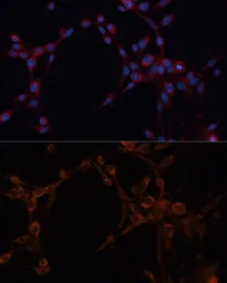 Anti-ALDH6A1 antibody used in Immunocytochemistry/ Immunofluorescence (ICC/IF). GTX64647