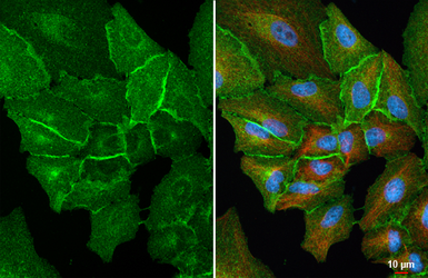 Anti-xCT / SLC7A11 antibody [HL5661] used in Immunocytochemistry/ Immunofluorescence (ICC/IF). GTX646470