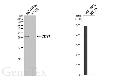 Anti-CD99 antibody [HL5666] used in Western Blot (WB). GTX646475