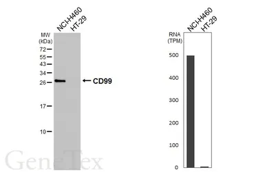 Anti-CD99 antibody [HL5668] used in Western Blot (WB). GTX646477