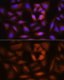 Anti-BRRN1 antibody used in Immunocytochemistry/ Immunofluorescence (ICC/IF). GTX64648