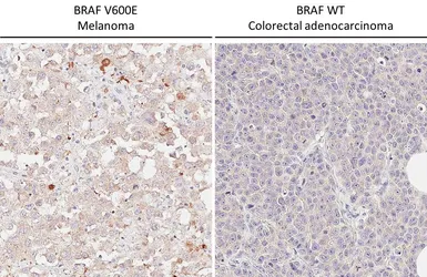 Anti-B-Raf (V600E Mutant) antibody [HL5673] used in IHC (Paraffin sections) (IHC-P). GTX646482